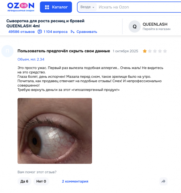 Queenlash отзывы: стоит ли верить обещаниям о густых ресницах?