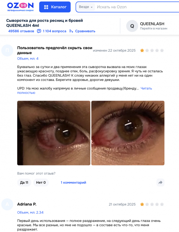 Queenlash отзывы: что скрывается за обещаниями идеальных ресниц
